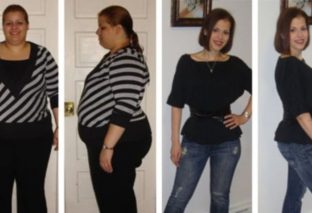 Weight Loss Mistakes Bariatric Surgery Patients Make